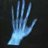 xray